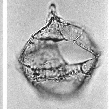 3_Cribroperidinium_cavagnettii_paratype-1.jpg