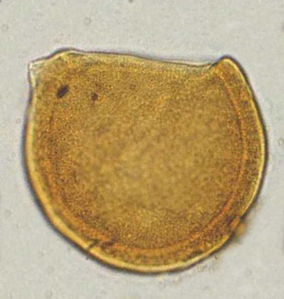 A_crassus, Slimani and Louwye, 2013, Review of Palaeobotany and Palynology, v.192 -- 6.jpg