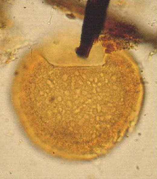 A_crassus, Slimani and Louwye, 2013, Review of Palaeobotany and Palynology, v.192 -- 8.jpg