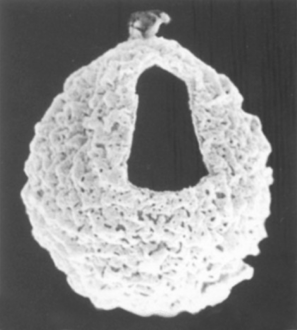 A_scaldemense, Louwye, 2001, Geobios, v.34, no.2 -- 10.jpg