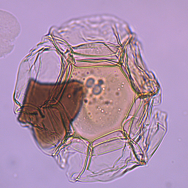 Actinotheca_aphroditae_U1580_37R_5_89_sl2.jpg