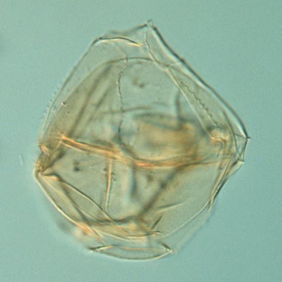 Athigmatocysta_glabra_fig2_7fd46_4.jpg