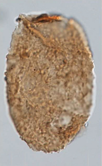 B_elongata, Vitacca et al., 2022, Review of Palaeobotany and Palynology 304 -- 11.jpg