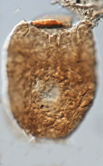 B_elongata, Vitacca et al., 2022, Review of Palaeobotany and Palynology 304 -- 13.jpg