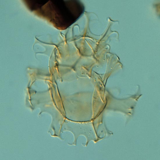 Callaiosphaeridium_tricherum_fig2_fd33_2.jpg