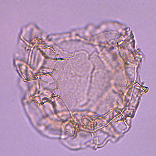 Cauveridinium_membraniphorum_U1580_38R_5_90_sl2.jpg