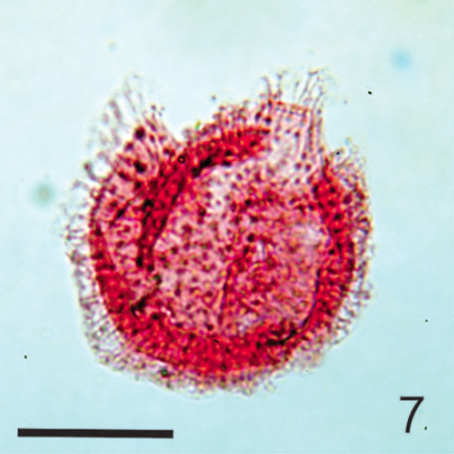 Chlamydophorella-ejuncida_Williams-Fensome-2025_P1F7_Holotype_NUPB-960_sb20um.png