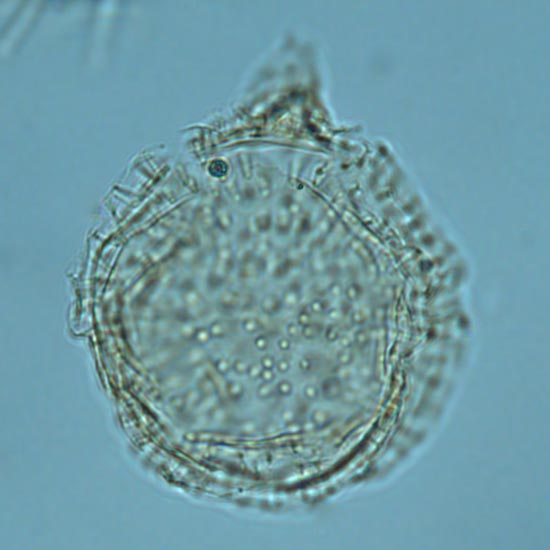 Chlamydophorella_nyei_fig2_fd11_4.jpg