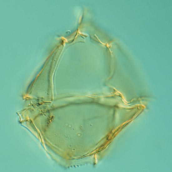 Gonyaulacysta_kleithria_fig1_4fd62_1.jpg