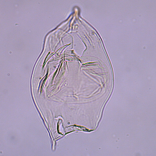 Isabelidinium_glabrum_U1580_37R_3_4_sl2.jpg