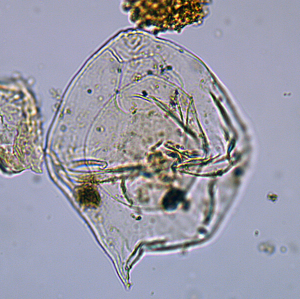 Isabelidinium_glabrum_U1580_40R_3_26_sl2.jpg