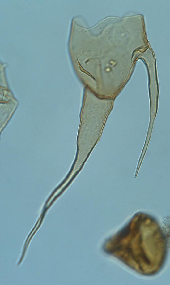 Odontochitina_operculata_fig1_3fd22_1.jpg
