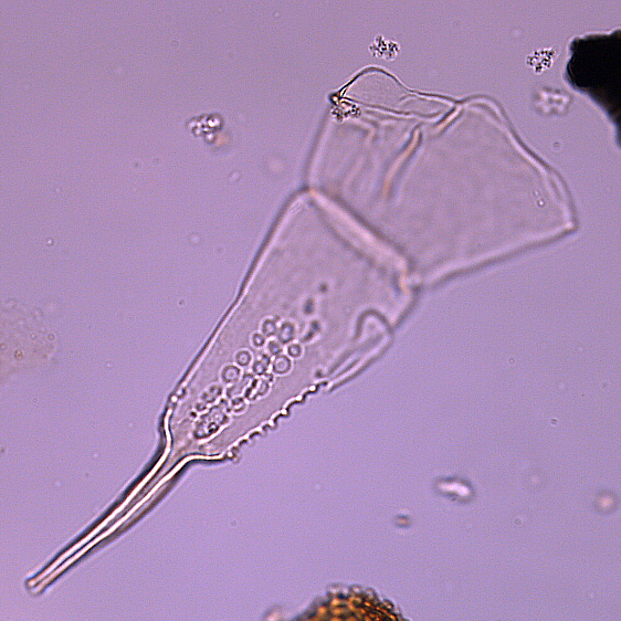 Odontochitina_porifera_U1580_37R_3_4_sl2.jpg