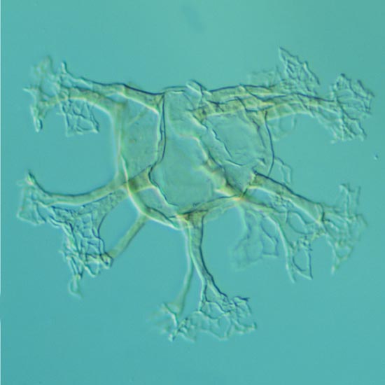 Oligosphaeridium_perforatum_colum_fig2_4fd116_1.jpg