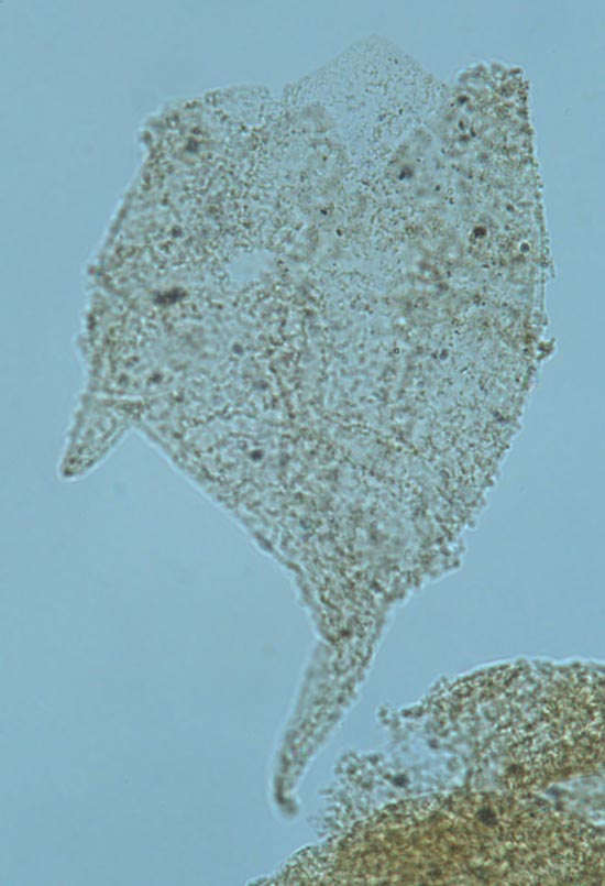 Pseudoceratium_pelliferum_fig2_3fd37_1.jpg