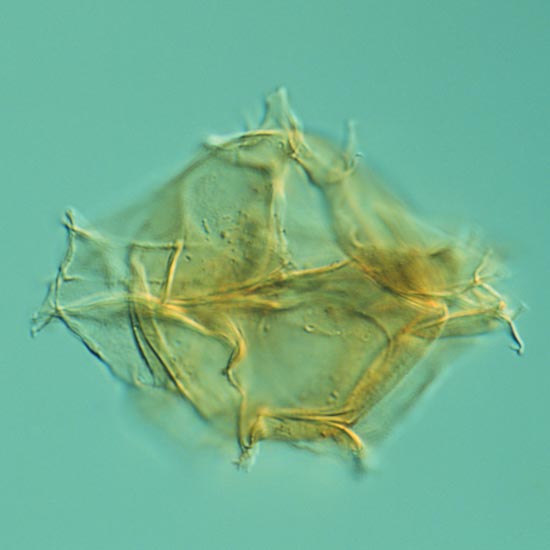 Stephodinium_spinulosum_fig1_4fd67_1.jpg