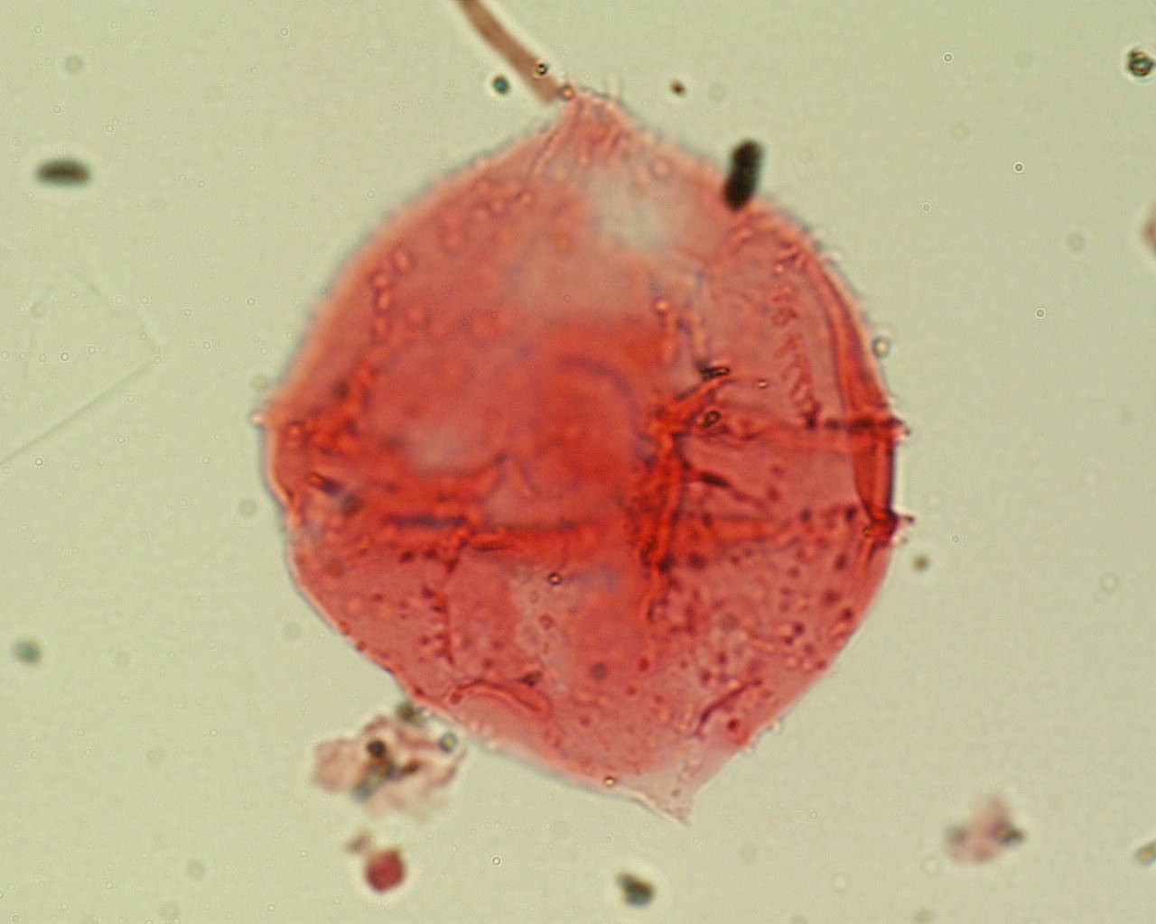 Spinidinium boydii.jpg