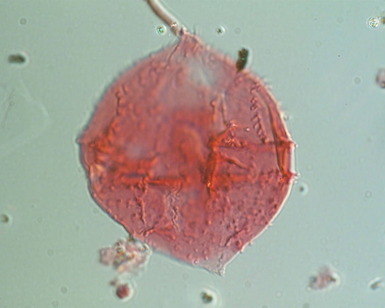 Spinidinium boydii.jpg