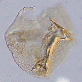 Atopodinium haromense