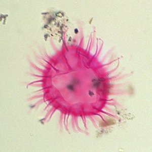 Cleistosphaeridium clavulum.jpg