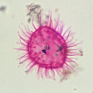 Cleistosphaeridium clavulum.jpg