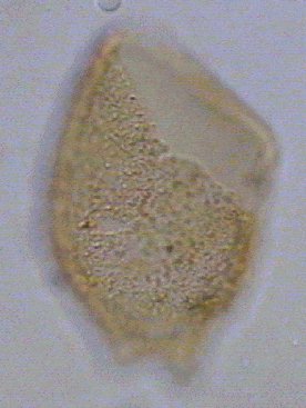 Batioladinium micropodum.jpg