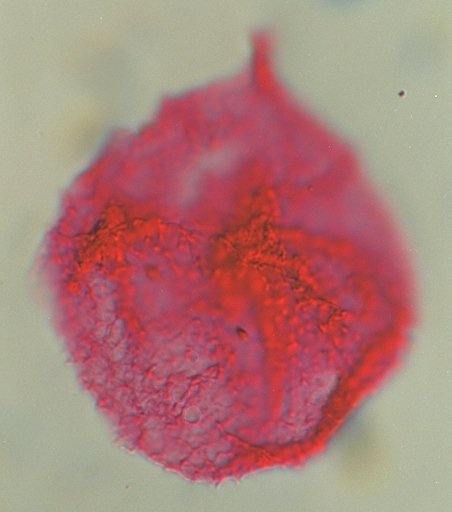 Millioudodinium spinoreticulatum.jpg