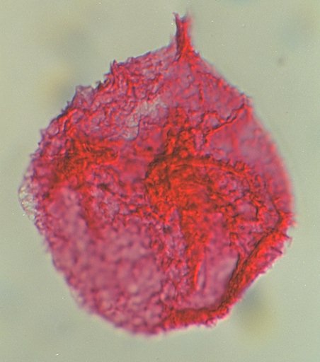 Millioudodinium spinoreticulatum.jpg