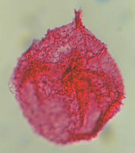 Millioudodinium spinoreticulatum.jpg