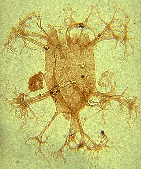 Distatodinium paradoxum.jpg