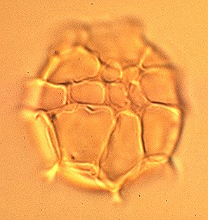 Cladopyxidium saeptum.jpg