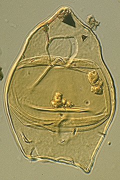 Isabelidinium cooksoniae.jpg