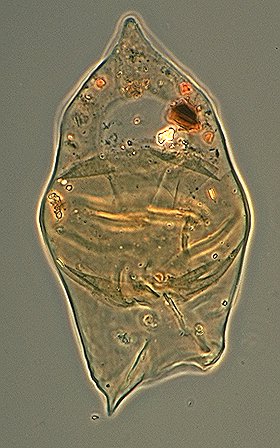 Isabelidinium cooksoniae.jpg