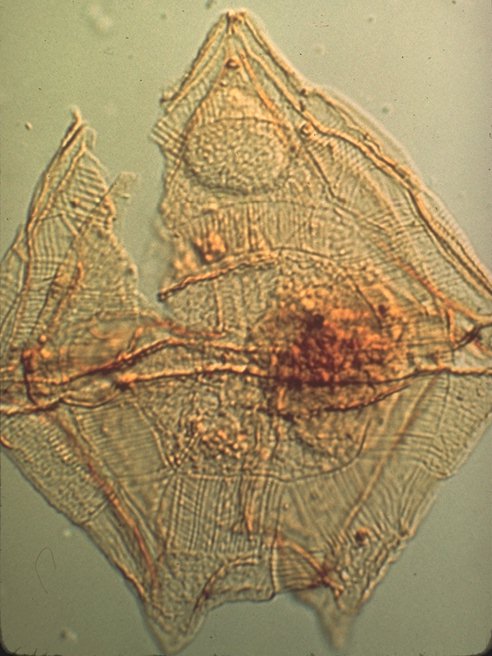 Palaeoperidinium pyrophorum.jpg