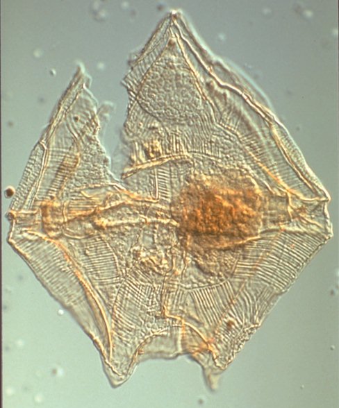 Palaeoperidinium pyrophorum.jpg