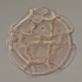 Cladopyxidium saeptum.jpg