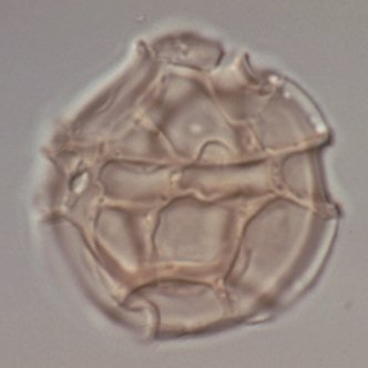 Cladopyxidium saeptum.jpg