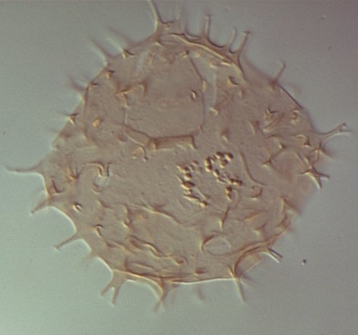 Apectodinium homomorphum.jpg