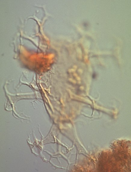 Distatodinium paradoxum.jpg