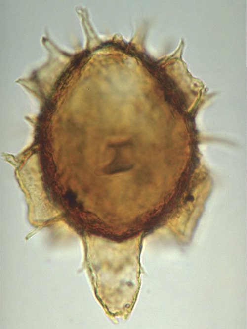 Hystrichosphaeridium biformoides.jpg