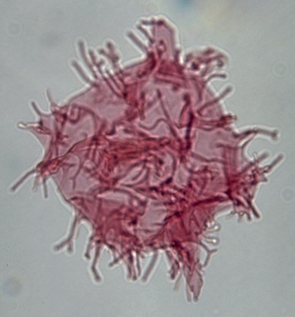 Apectodinium homomorphum.jpg