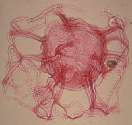 Adnatospaeridium apiculatum.jpg