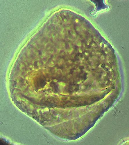 Rhombodella kendelbachia.jpg