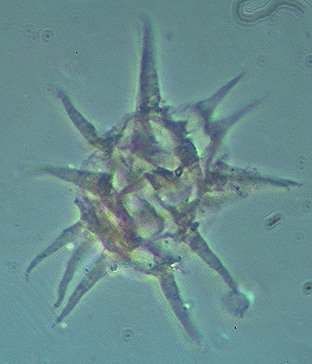 Cleistosphaeridium mojsisovicsii.jpg