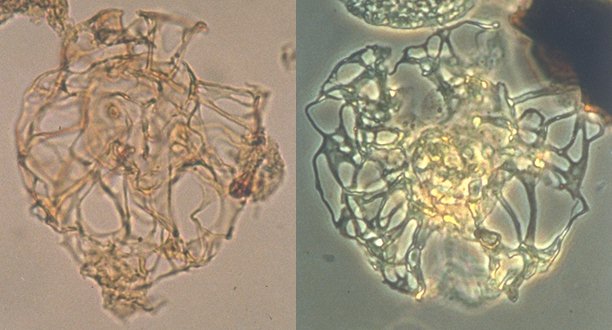 Adnatosphaeridium filamentosum.jpg