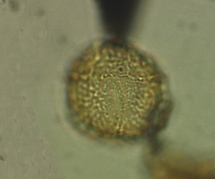 microdiniumb23241.jpg