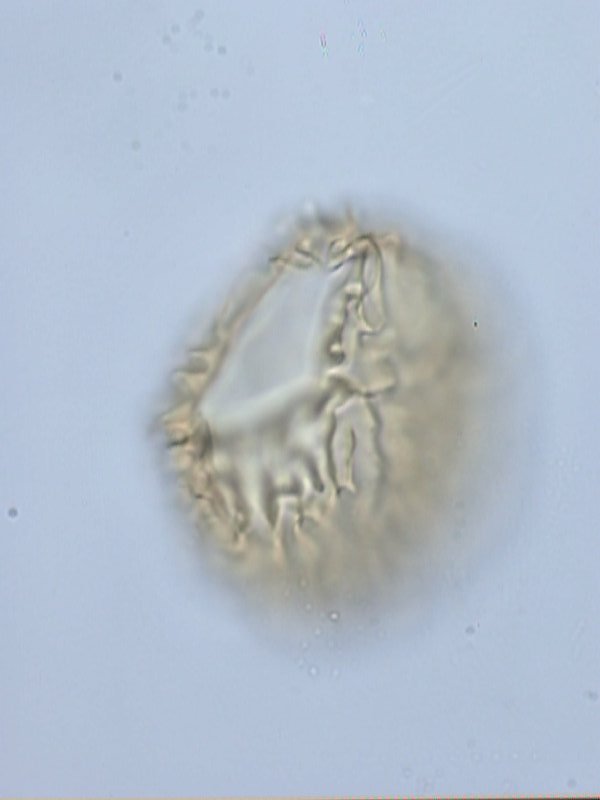 Ellipsodinium rugulosum.jp