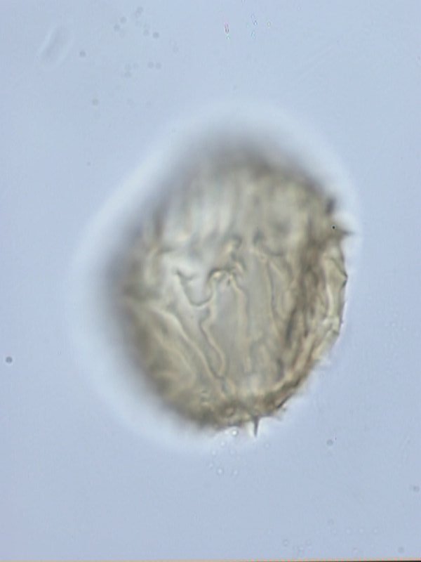 Ellipsodinium rugulosum.jpg