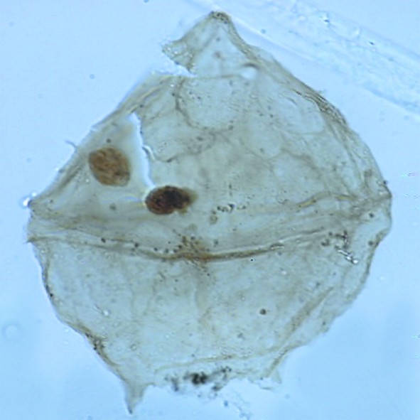 Palaeoperidinium pyrophorum.jpg