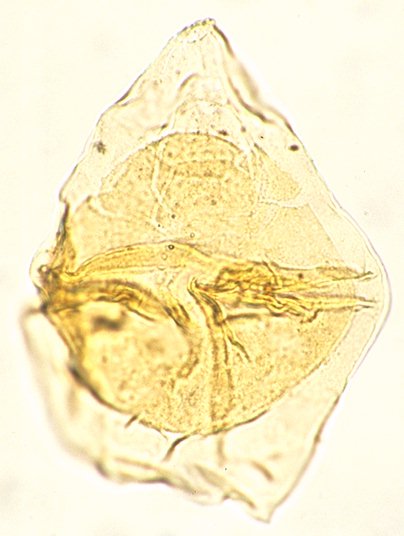 Alterbidinium daveyi.jpg